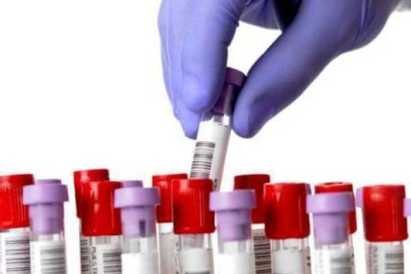 Nuevo centro de test rápidos y asesorías en salud sexual
